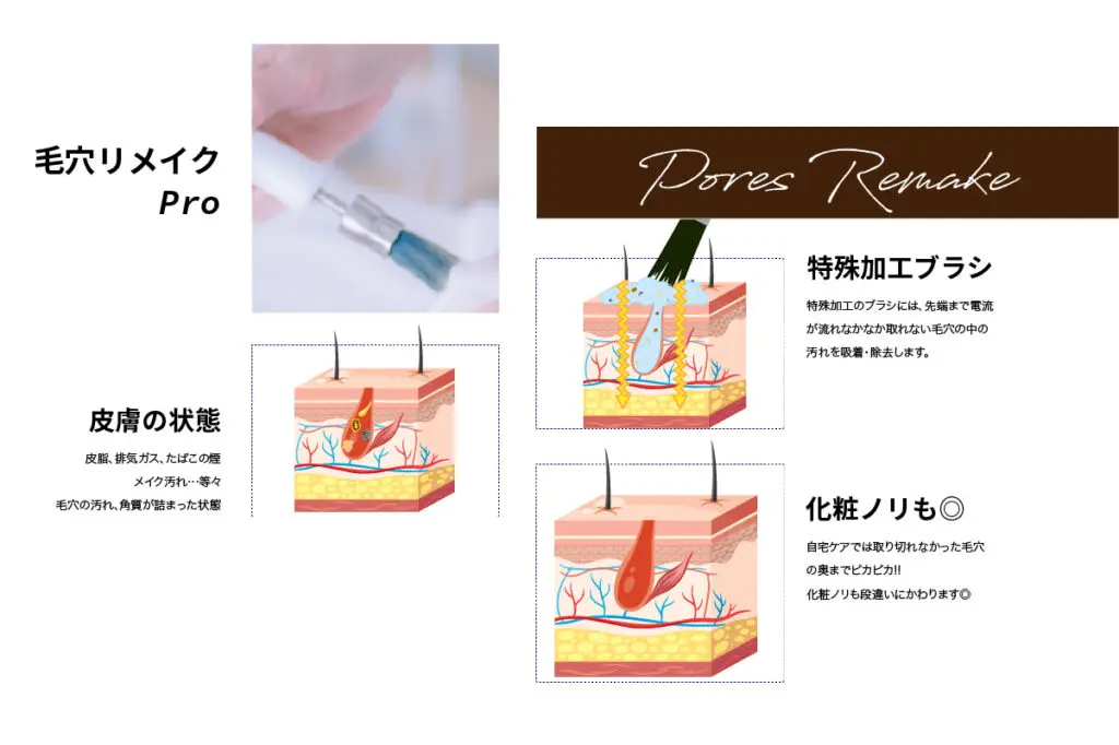 毛穴リメイクプロ 100