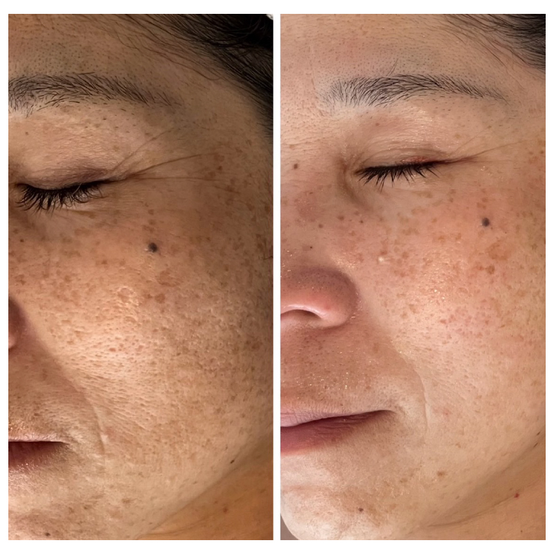 MENU美肌 美肌 1 100