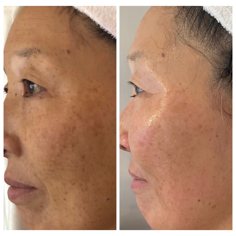 MENU美肌 美肌2 100