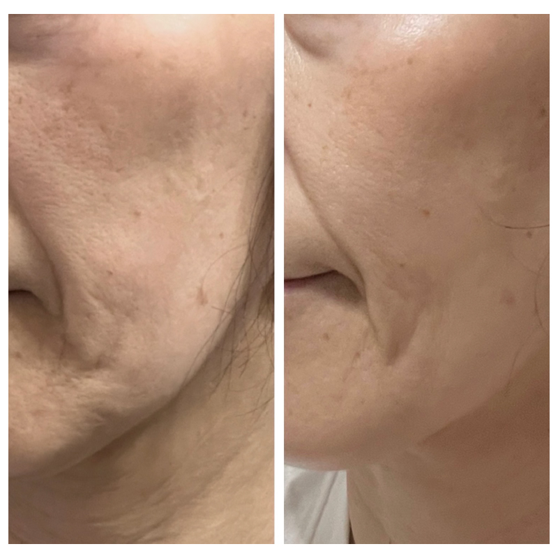 MENU美肌 美肌3 100