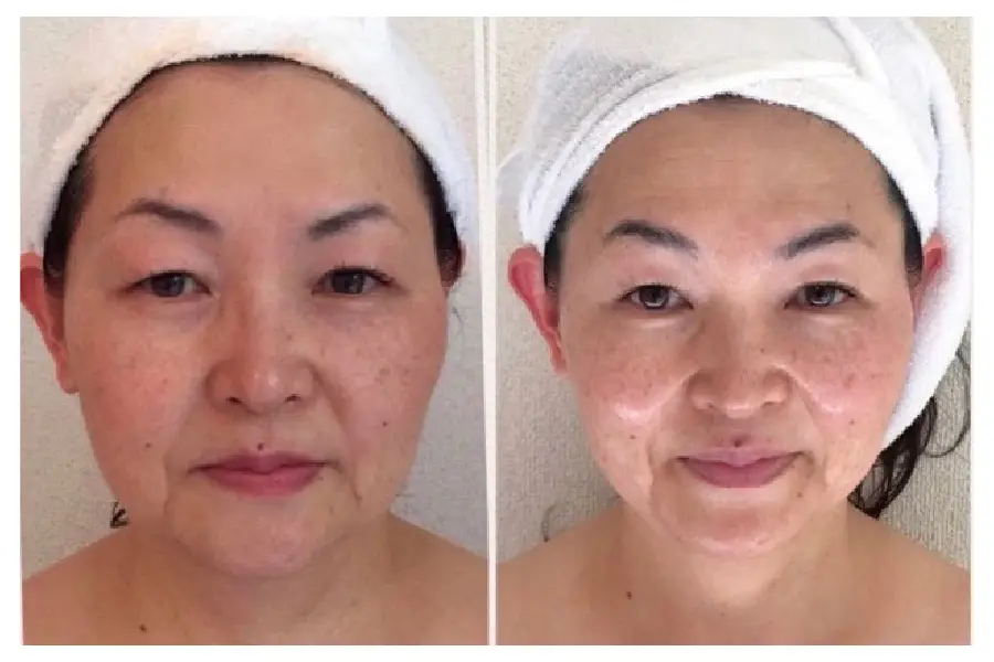 造形美f 変化1 100