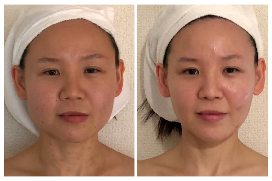 造形美f 変化2 100